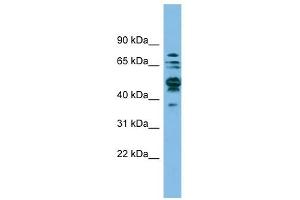 SHMT1 antibody used at 1 ug/ml to detect target protein. (SHMT1 anticorps)
