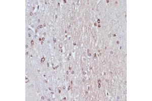 Immunohistochemistry of paraffin-embedded rat brain using TPD52 antibody  at dilution of 1:100 (40x lens). (TPD52 anticorps  (AA 1-184))