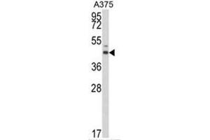 Western blot analysis of ESRRA Antibody (Center) in A375 cell line lysates (35ug/lane). (ESRRA anticorps  (Middle Region))