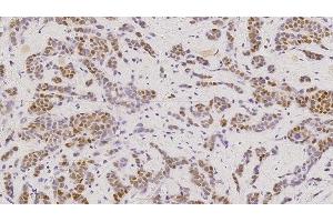 Immunohistochemistry (IHC) image for anti-Estrogen Receptor 1 (ESR1) antibody (ABIN7538886) (Estrogen Receptor alpha anticorps)