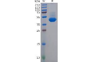 Human NECTIN-4 Protein, His Tag on SDS-PAGE under reducing condition. (PVRL4 Protein (AA 32-349) (His tag))