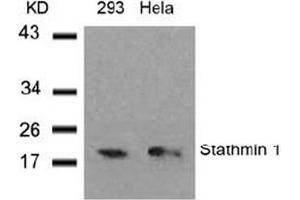 Image no. 3 for anti-Stathmin 1 (STMN1) (Ser37) antibody (ABIN197457) (Stathmin 1 anticorps  (Ser37))