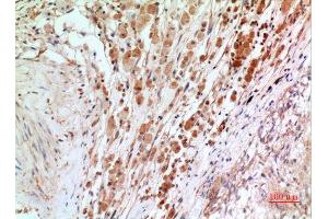 Immunohistochemistry (IHC) analysis of paraffin-embedded Human Brain, antibody was diluted at 1:100. (NF-kB p65 anticorps  (Thr743))
