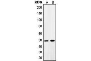 Western blot analysis of PDK1 expression in LNCaP (A), A431 (B) whole cell lysates. (PDPK1 anticorps  (Center))