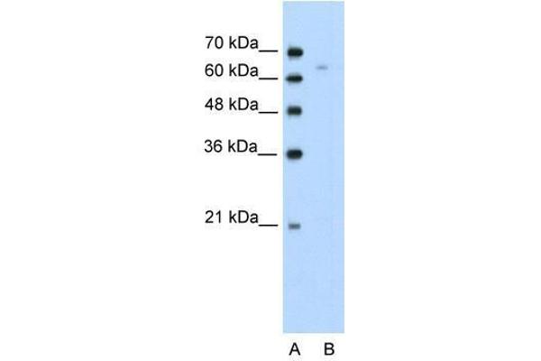 TOX anticorps  (N-Term)