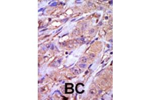 Immunohistochemistry (IHC) image for anti-Casein Kinase 1, epsilon (CSNK1E) antibody (ABIN3003191) (CK1 epsilon anticorps)