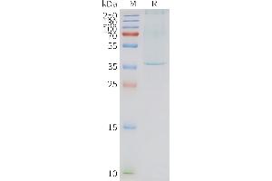 Human N-Nanodisc, Flag Tag on SDS-PAGE (NTSR1 Protéine)