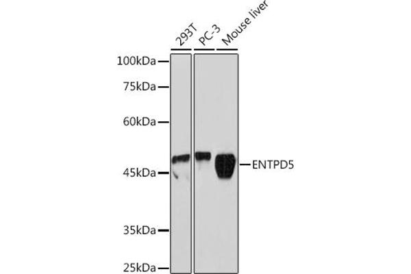 ENTPD5 anticorps