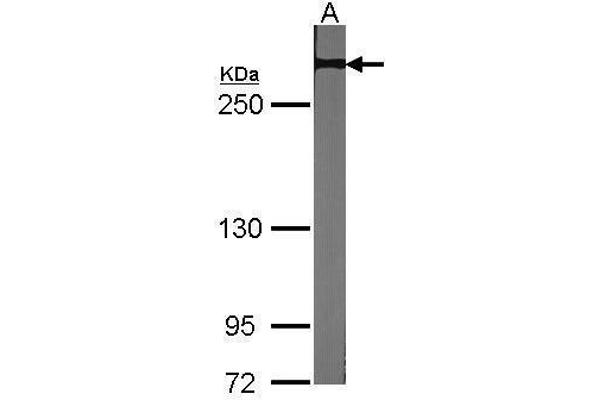 NOTCH2 anticorps  (C-Term)