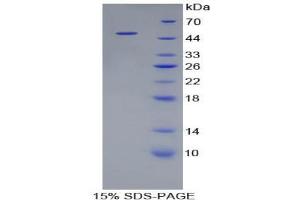 SDS-PAGE analysis of Pig Cathepsin L Protein. (Cathepsin L Protéine)