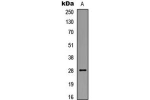 Western blot analysis of BCL2 (pS87) expression in HEK293T UV-treated (A) whole cell lysates. (Bcl-2 anticorps  (pSer87))