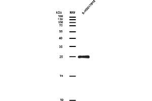 Gel:15 % SDS-PAGE Elution :0. (HSD17B10 Protein (AA 2-261) (S tag))