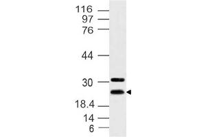 Image no. 1 for anti-Hairy and Enhancer of Split 7 (HES7) antibody (ABIN5027717) (HES7 anticorps)