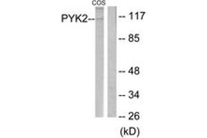 Western blot analysis of extracts from COS cells, treated with UV 15', using PYK2 (Ab-580) Antibody. (PTK2B anticorps  (AA 546-595))