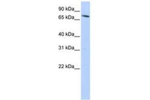 Image no. 1 for anti-Solute Carrier Family 11 (Proton-Coupled Divalent Metal Ion Transporters), Member 2 (SLC11A2) (N-Term) antibody (ABIN6743200) (SLC11A2 anticorps  (N-Term))