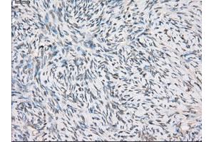 Immunohistochemical staining of paraffin-embedded colon tissue using anti-FCGR2A mouse monoclonal antibody. (FCGR2A anticorps)