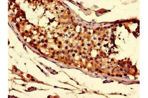 Immunohistochemistry of paraffin-embedded human testis tissue using ABIN7170279 at dilution of 1:100 (Solute Carrier Family 52 (Riboflavin Transporter), Member 3 (SLC52A3) (AA 159-220) anticorps)