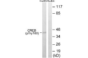 Western blot analysis of extracts from HUVEC cells, treated with etoposide (25uM, 24hours), using CREB (Phospho-Thr100) antibody. (CREB1 anticorps  (pThr100))