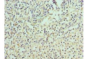 Immunohistochemistry of paraffin-embedded human spleen tissue using ABIN7166400 at dilution of 1:100 (PAD4 anticorps  (AA 1-250))