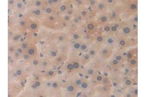 Detection of APP in Mouse Liver Tissue using Polyclonal Antibody to Amyloid Precursor Protein (APP) (APP anticorps  (AA 672-711))