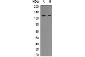 Western blot analysis of RB1 (pS807) expression in HEK293T (A), HuvEc (B) whole cell lysates. (Retinoblastoma 1 anticorps  (C-Term, pSer807))