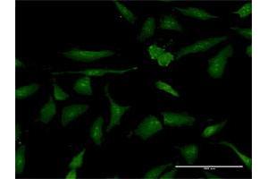 Immunofluorescence of purified MaxPab antibody to PSME3 on HeLa cell. (PSME3 anticorps  (AA 1-254))