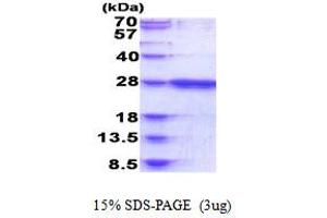 RAB39B Protein (AA 1-213) (His tag)