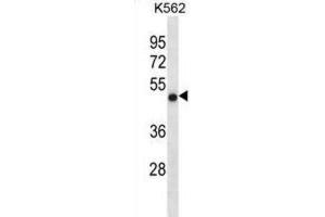 Western Blotting (WB) image for anti-Coiled-Coil Domain Containing 6 (CCDC6) antibody (ABIN3000929) (CCDC6 anticorps)