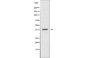 Western blot analysis of extracts from A549 cells using ALDOA antibody. (ALDOA anticorps  (N-Term))