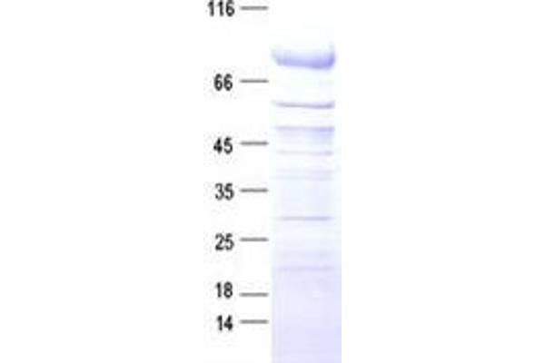 TMPRSS6 Protein (DYKDDDDK Tag)