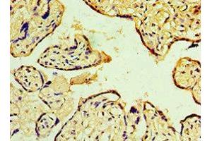 Immunohistochemistry of paraffin-embedded human placenta tissue using ABIN7150705 at dilution of 1:100 (MAP2K3 anticorps  (AA 1-170))