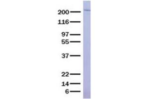 Validation with Western Blot (Angiopoietin 1 Protein (ANGPT1) (Transcript Variant 1) (His tag))