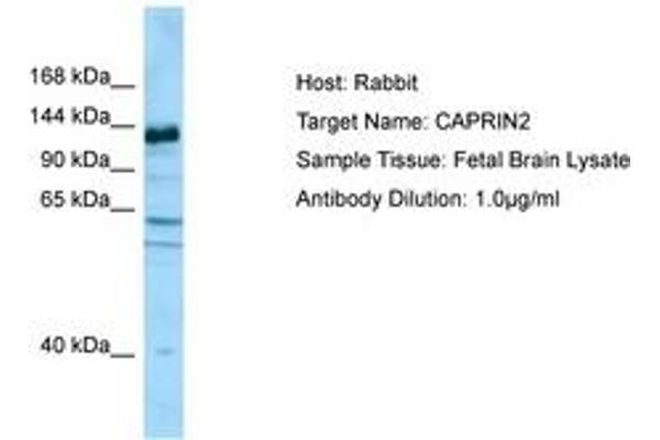 CAPRIN2 anticorps  (AA 924-973)