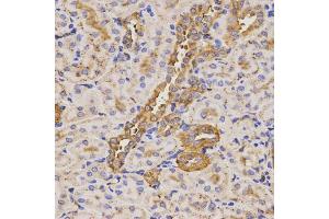 Immunohistochemistry of paraffin-embedded rat kidney using KLK5 antibody (ABIN5971539) at dilution of 1/200 (40x lens). (Kallikrein 5 anticorps)