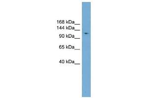 LIG1 antibody used at 1 ug/ml to detect target protein. (LIG1 anticorps  (Middle Region))