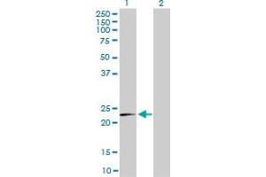 Western Blotting (WB) image for anti-Mitochondrial Ribosomal Protein L12 (MRPL12) (AA 1-198) antibody (ABIN562710)