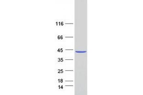 MAT2B Protein (Transcript Variant 1) (Myc-DYKDDDDK Tag)