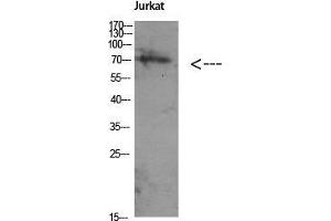 Western Blot (WB) analysis of Jurkat using Antibody diluted at 1:1000. (ATG16L1 anticorps  (Internal Region))