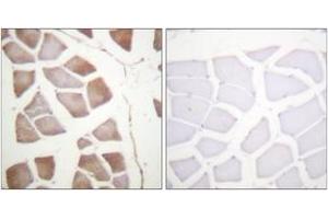 Immunohistochemistry analysis of paraffin-embedded human skeletal muscle, using DAPK2 (Ab-318) Antibody. (DAPK2 anticorps  (AA 284-333))