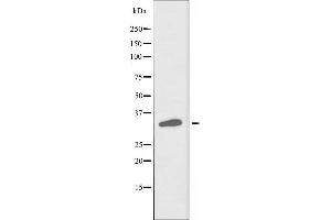 Western blot analysis of extracts from COLO cells, using PHCA antibody. (ACER3 anticorps  (Internal Region))