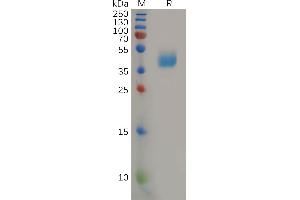 Human Protein, hFc Tag on SDS-PAGE under reducing condition. (CCR2 Protein (AA 1-42) (Fc Tag))