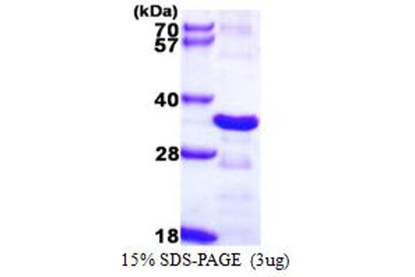 CHMP2B Protein (AA 1-213) (His tag)