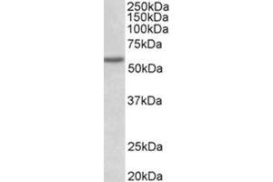Western Blotting (WB) image for anti-Programmed Cell Death 4 (PDCD4) (Internal Region) antibody (ABIN1108603) (PDCD4 anticorps  (Internal Region))