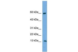 WB Suggested Anti-C20orf144 Antibody Titration: 0. (C20orf144 anticorps  (Middle Region))