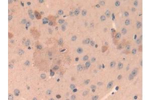 DAB staining on IHC-P; Samples: Mouse Cerebrum Tissue (Cathepsin L anticorps  (AA 18-113))