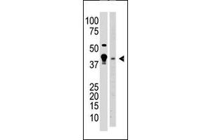 The anti-MBD2 N-term Antibody (ABIN387915 and ABIN2844333) is used in Western blot to detect MBD2 in  cell lysate (lane 1) and mouse brain tissue lysate (lane 2) lysate. (MBD2 anticorps  (AA 120-151, AA 120-152))