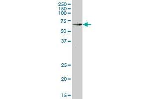 KLF10 monoclonal antibody (M14), clone 2E7. (KLF10/TIEG1 anticorps  (AA 111-210))