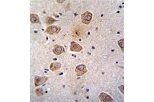 Formalin fixed, paraffin embedded human brain tissue stained with RLBP1L2 Antibody (C-term) followed by peroxidase conjugation of the secondary antibody and DAB staining. (CLVS2 anticorps  (C-Term))