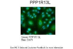 Sample Type :  Human lung adenocarcinoma cell line A549  Primary Antibody Dilution :  1:100  Secondary Antibody :  Goat anti-rabbit AlexaFluor 488  Secondary Antibody Dilution :  1:400  Color/Signal Descriptions :  PPP1R13L: Green DAPI:Blue  Gene Name :  PPP1R13L   Submitted by :  Dr. (PPP1R13L anticorps  (Middle Region))
