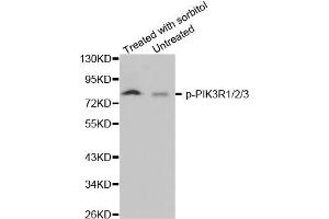 Western blot analysis of extracts from 293 cells, using phospho-PIK3R1/2/3-Y467 antibody (PIK3R1 + PIK3R2 + PIK3R3 (pTyr467) anticorps)